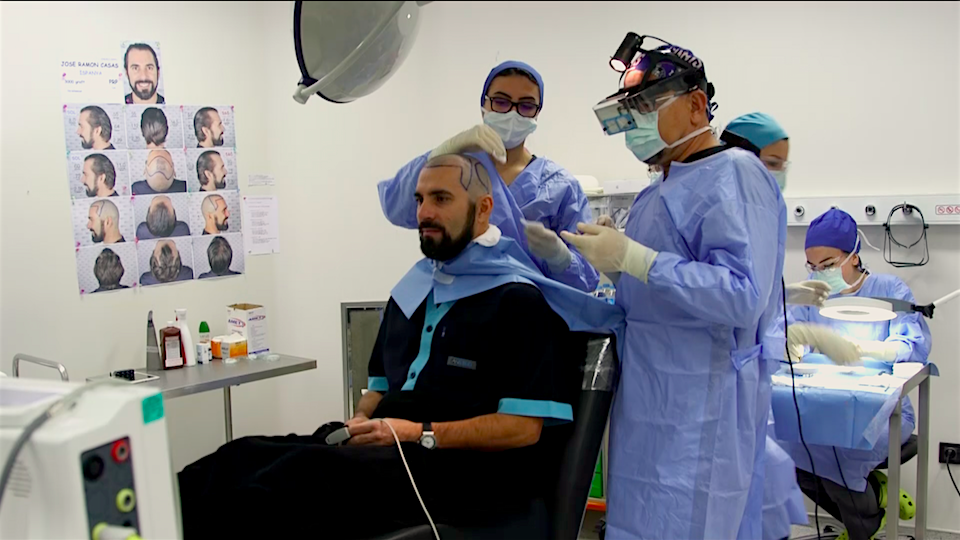 Istanbul hair transplant