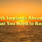 Teeth Implants Abroad — What You Need to Know