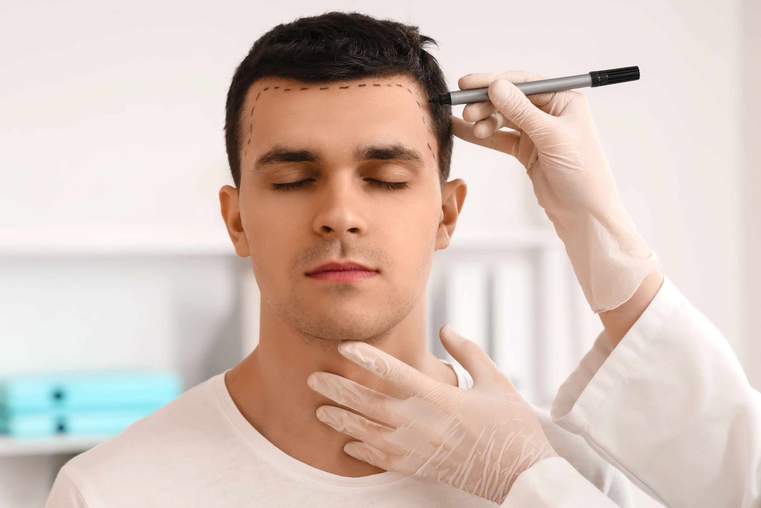 What Is Hair Transplant Turkiye